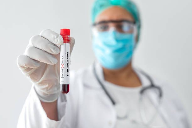 Tindakan Cepat Dinkes Banyuwangi, Cegah Kasus Monkeypox