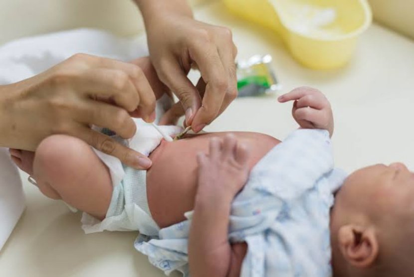 Perawatan Tali Pusat Bayi Baru Lahir yang Benar, Cegah Infeksi